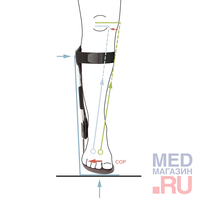 Голеностопный корригирующий ортез 50K4 Agilium Freestep 2.0 Ottobock