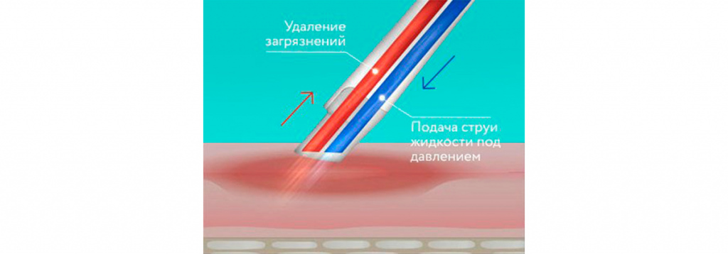 234111.jpg 234111.jpg