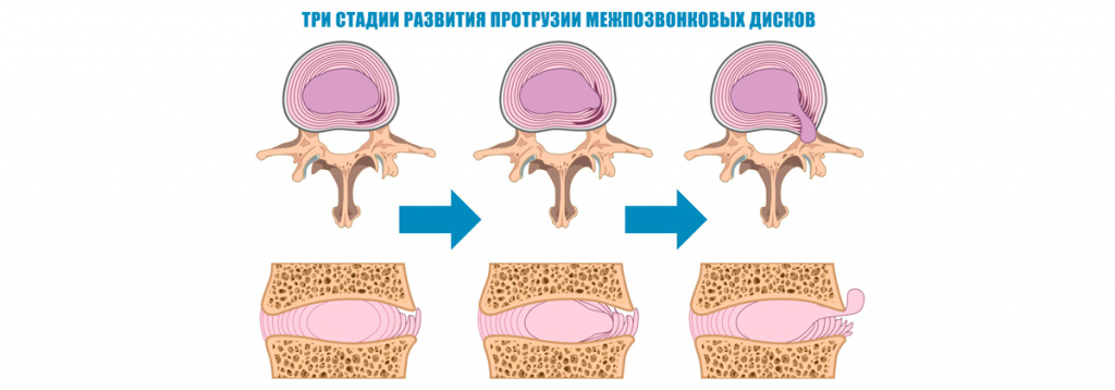 2.jpg 2.jpg