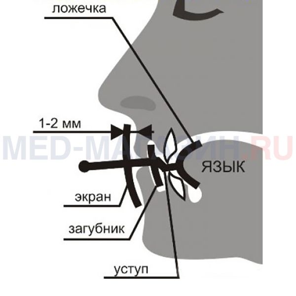 Устройство для предупреждения и лечения храпа Экстра-лор